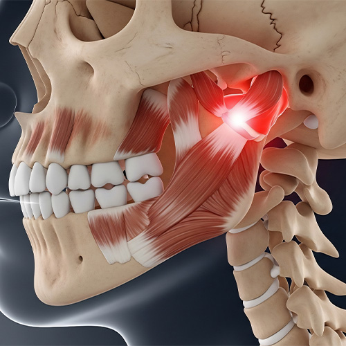 Diagram Showing Bones and Muscles Surrounding Area of TMJ Pain
